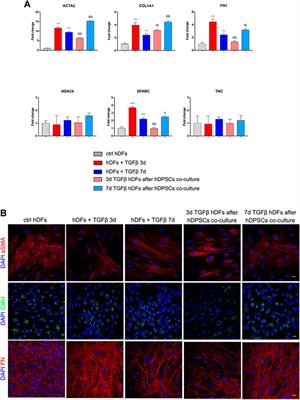 Human dental pulp stem cells (hDPSCs) promote the lipofibroblast transition in the early stage of a fibro-inflammatory process